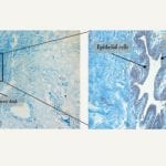 Characterization of the transition of naive fibroblast to cancer associated fibroblasts using 3D co-cultures