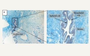Characterization of the transition of naive fibroblast to cancer associated fibroblasts using 3D co-cultures